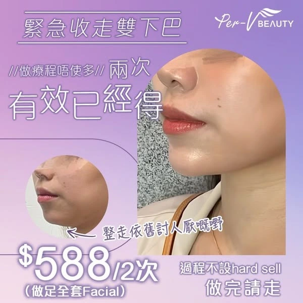 Thermafit 雙下巴改善圖