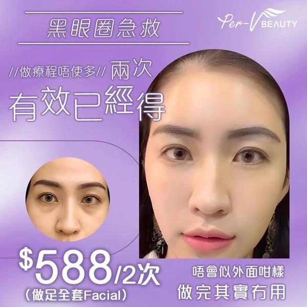 Thermafit 膠原槍